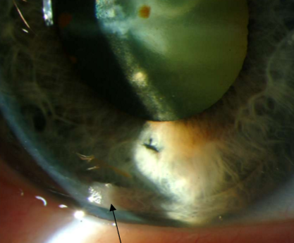 <p>What condition is this?</p>