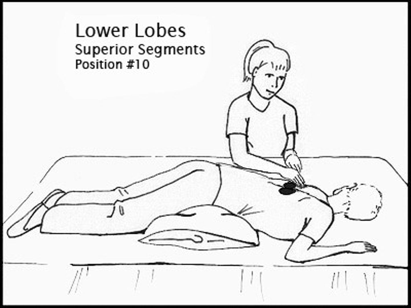 <p>*Patient position*: table flat. patient lays down on abdomen with 2 pillows under hips.</p><p>*PT*: percussion over middle back at tip of scapula .</p>