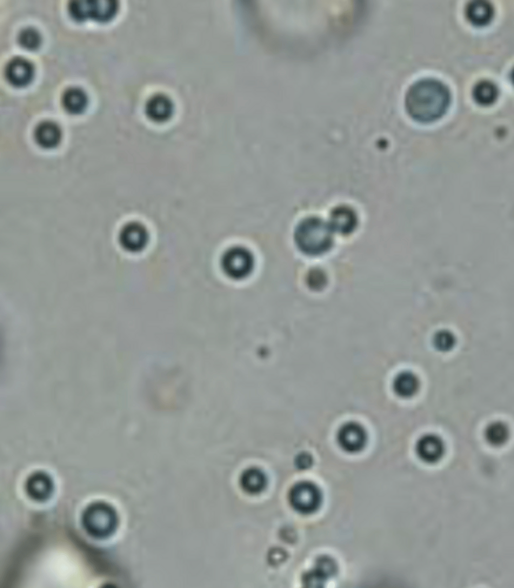 <p>- Highly refractile, round, vary in size</p><p>- Appear orange/red with sudan III stain</p><p>- Can be an artifact of catheterization due to lubrication of catheters</p><p>- Free-catch or cysto - typically seen in cats, dogs with diabetes, fat animals, high-fat diet</p>