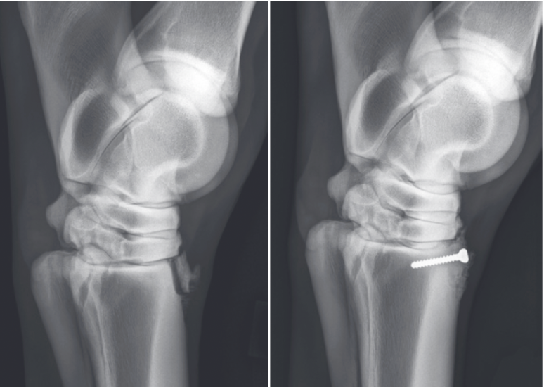 <ul><li><p><span>Occur sporadically in racehorses and can be confusing because the lameness associated with them is typically eliminated by local anesthetic injected into the middle carpal or tarsometatarsal joint</span></p></li><li><p><span>Sagittal fractures can be seen in any breed, most occur medial to midline and are best diagnosed on nuclear scintigraphy and DP radiographs</span></p></li><li><p><span>Incomplete sagittal fractures treated conservatively with 3 months of box rest have an excellent prognosis (98%)</span></p></li><li><p><span>Frontal/dorsal plan fractures occur in MCIII or MTIII</span></p><ul><li><p><span>In Standardbreds, fracture is most common in young pacers on the dorsomedial aspect of MCIII</span></p></li></ul></li><li><p><span>Proximal articular fractures have been treated conservatively with good success, but displaced frontal plane fractures are best repaired with internal fixation through cortex screws inserted in lag fashion, implant removal is generally not necessary</span></p></li></ul>