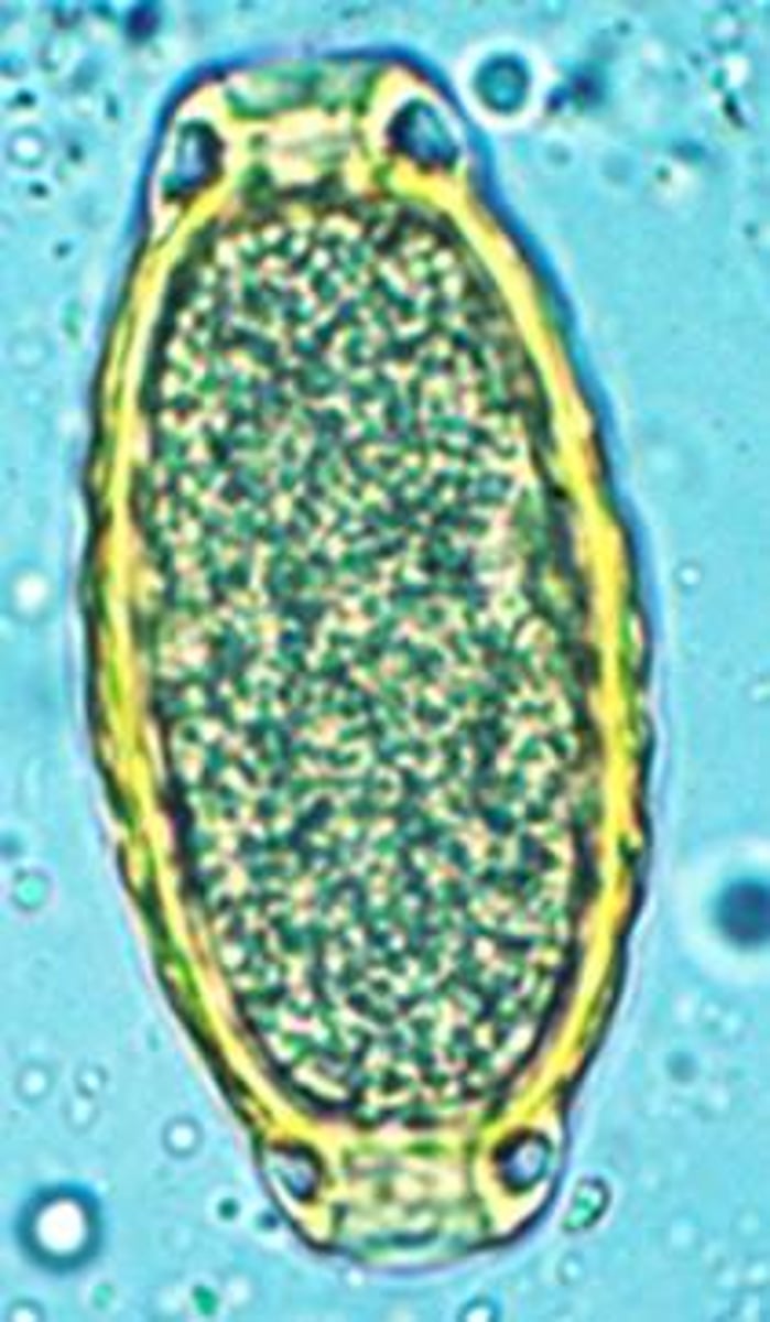 <p>What parasite produced this egg found in the urine sediment of a cat with cystitis?</p>