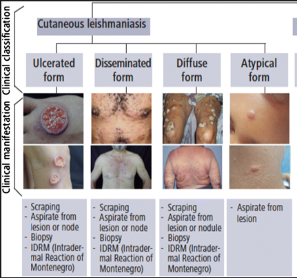 <p>Skin lesions, ulcerated sores.</p>
