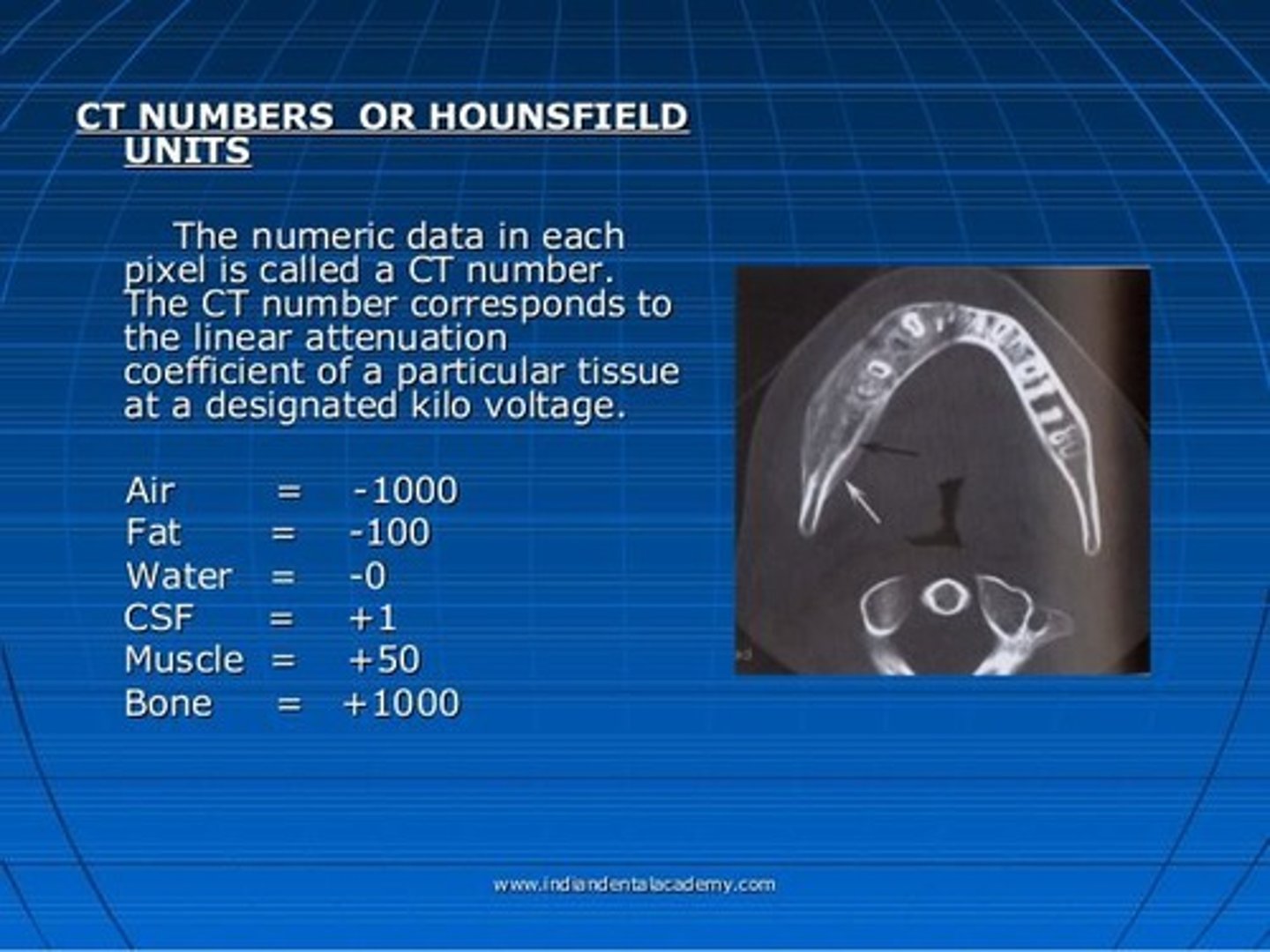 <p>A scale used in CT imaging that ranges from +1000 to -1000, representing various tissue densities and linear attenuation coefficients.</p>