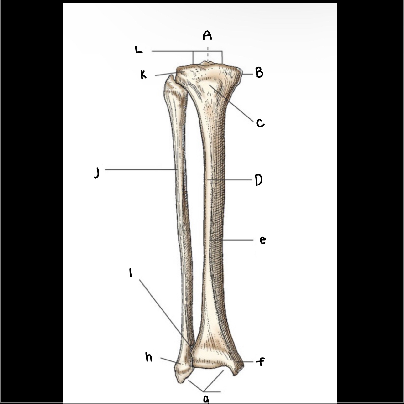 <p>What is letter D pointing to?</p>