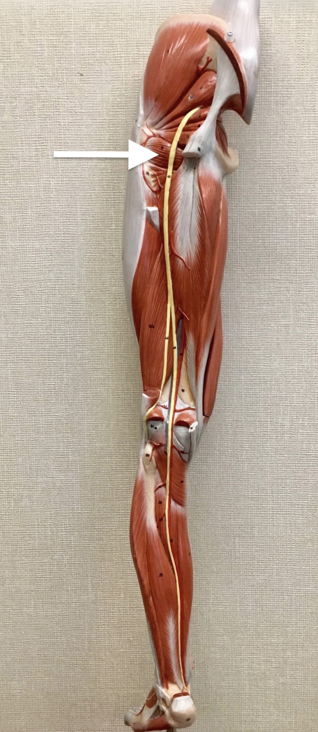 <p><span>Name the muscle labeled with the white arrow below:</span></p>