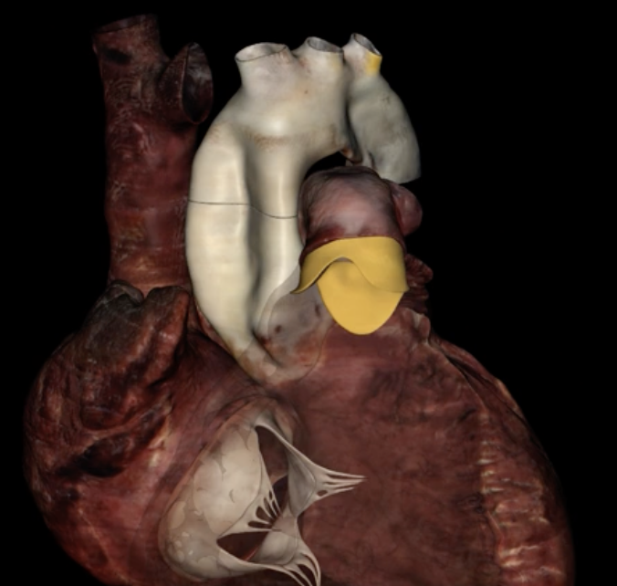 <p>What is highlighted in yellow?</p>