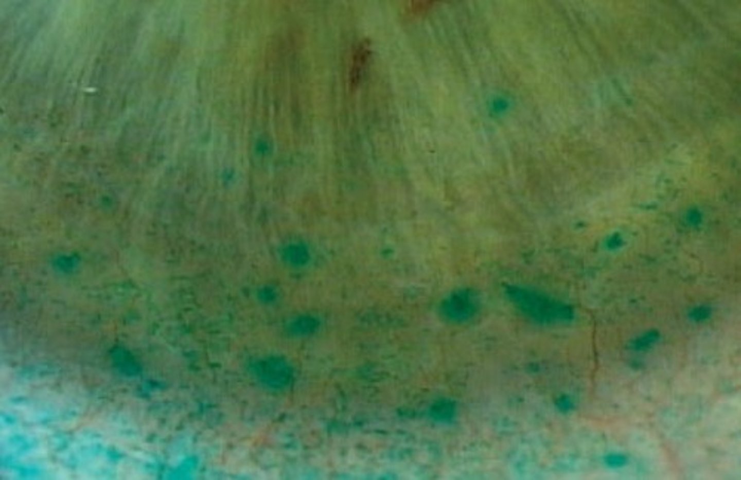 <p>Which dye is this:</p>