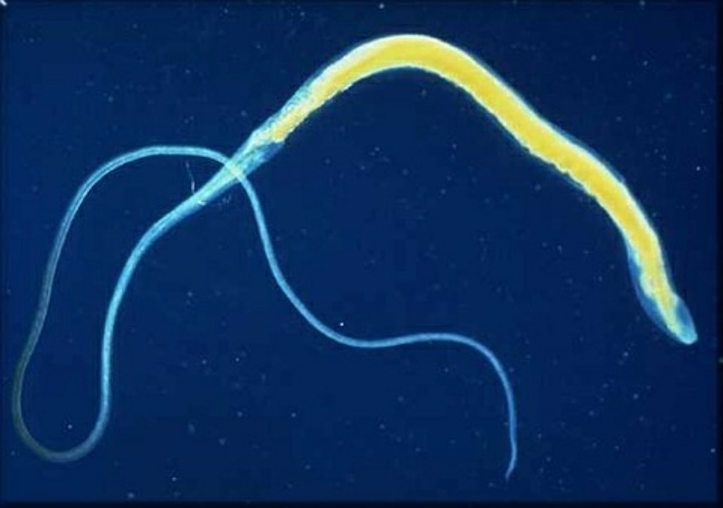 <p>they are parasitic worms with a thick tail and a whip-like body that infects the large intestine of the host. Trichuris Vulpis is a common type of whipworm that infects K-9s. Dogs, humans, pigs, rodents, and cats (rare) can get whipworm.</p>