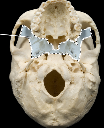 <p><span><strong>Sphenoid bone</strong></span></p>