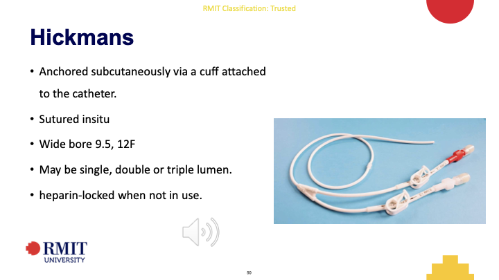 <p>A large bore vascular access device commonly inserted into</p><p class="p1">the subclavian vein and tunneled through subcutaneous</p><p class="p1">tissue prior to exiting the body.</p><p class="p1">Commonly used for stem cell transplant, chemotherapy or when long-</p><p class="p1">term central venous access is required.</p><p class="p1"></p><p class="p1">Anchored subcutaneously via a cuff attached</p><p class="p1">to the catheter.</p><p class="p1">• Sutured insitu</p><p class="p1">• Wide bore 9.5, 12F</p><p class="p1">• May be single, double or triple lumen.</p><p class="p1">• heparin-locked when not in use.</p>