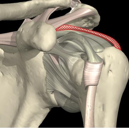 <p>Extends between coracoid process to both the lesser and greater humeral tubercles</p><p>strengthens the upper part of the shoulder capsule around ball-and-socket joint</p>