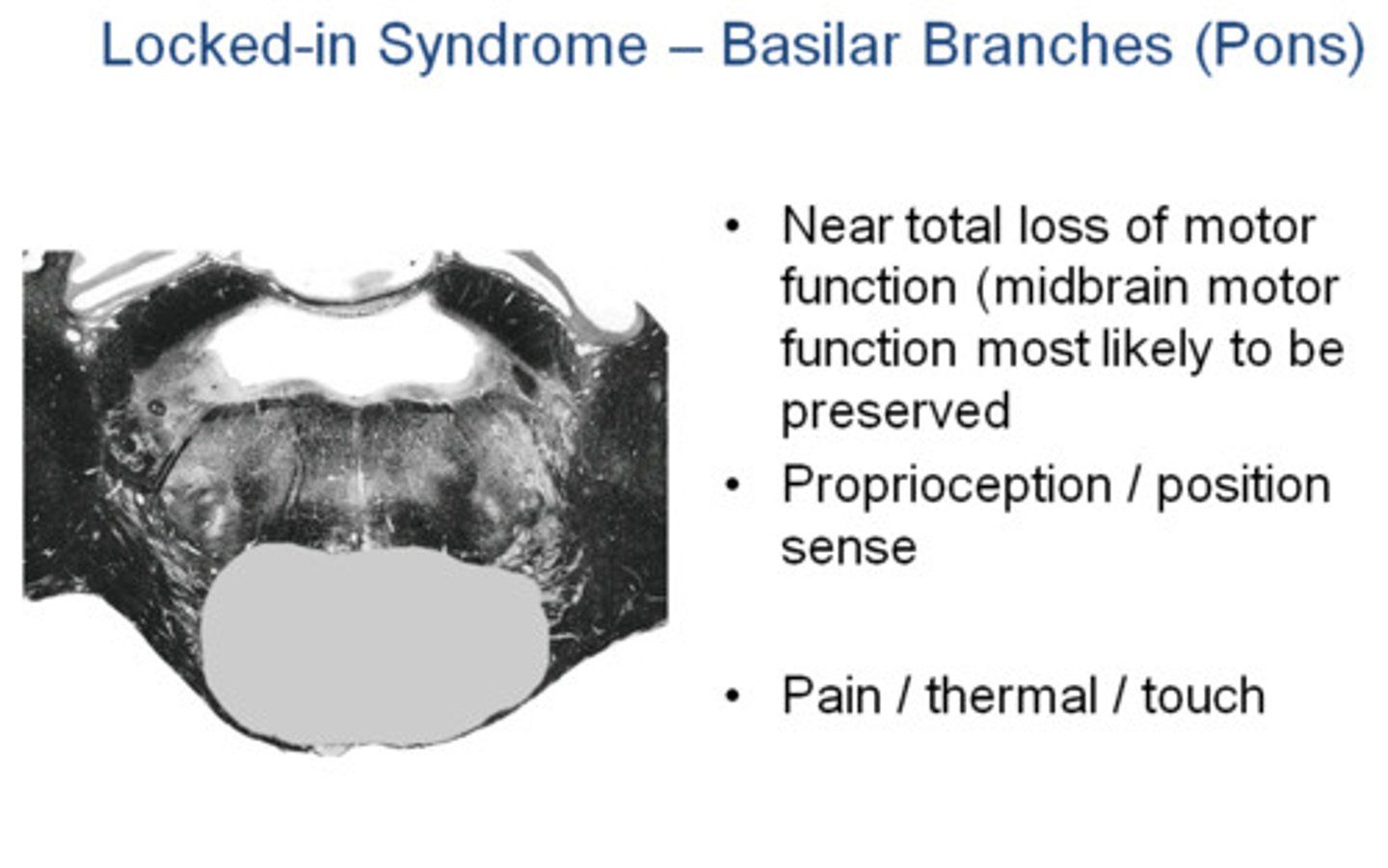 <p>What: Caused by thrombosis and BL infarction of ventral pons</p><p>Presentation:</p><p>-acute hemiparesis progressing to tetraplegia and lower bulbar paralysis (CN V-XII)</p><p>-Mutism</p><p>-Cannot move or speak but alert and oriented</p><p>-Vertical eye movement and blinking preserved</p>