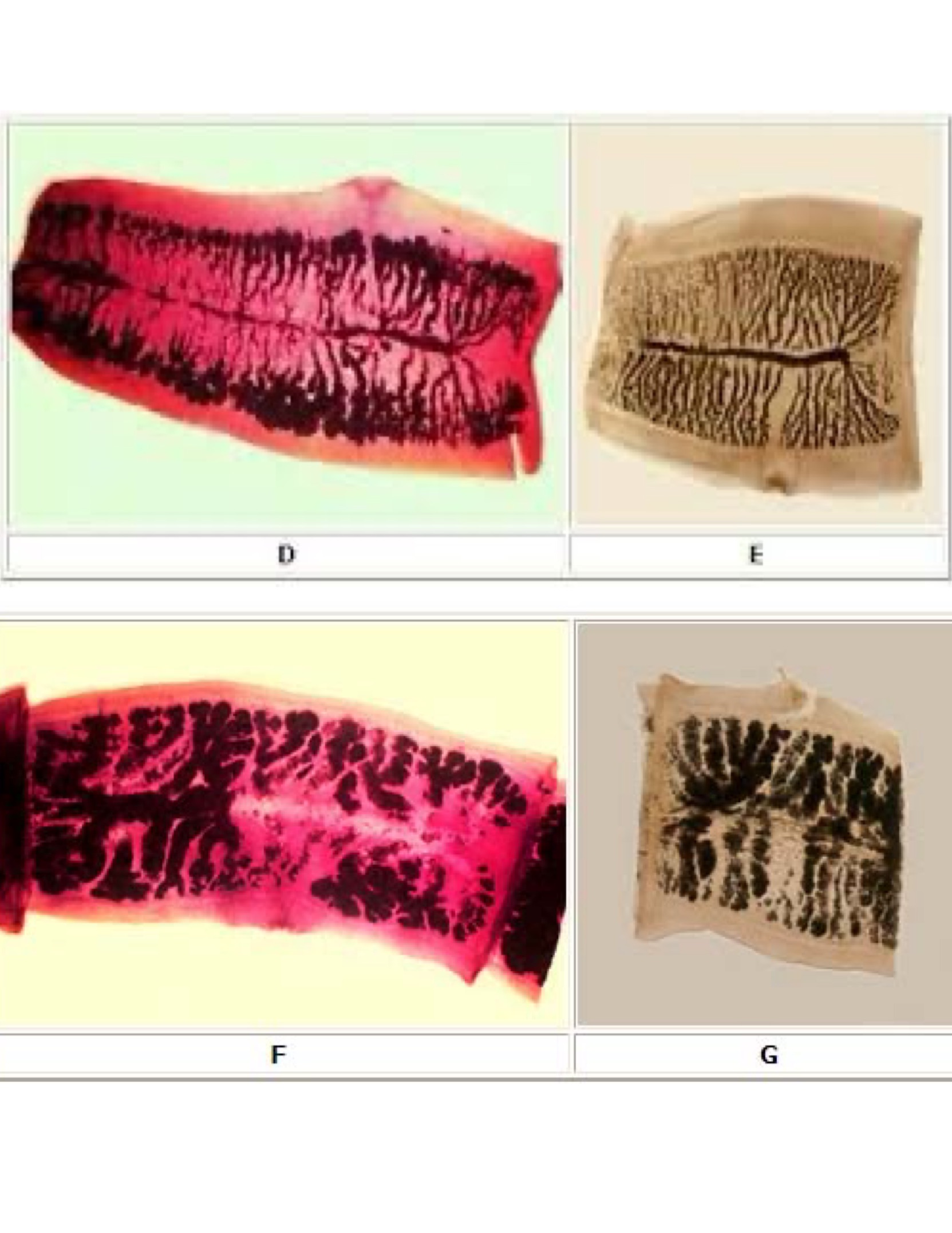 <p>Taenia solium proglottids</p>