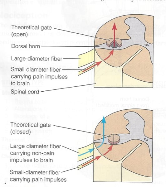 <p>the theory that the spinal cord contains a neurological "gate" that blocks pain signals or allows them to pass on to the brain. The "gate" is opened by the activity of pain signals traveling up small nerve fibers and is closed by activity in larger fibers or by information coming from the brain.</p>