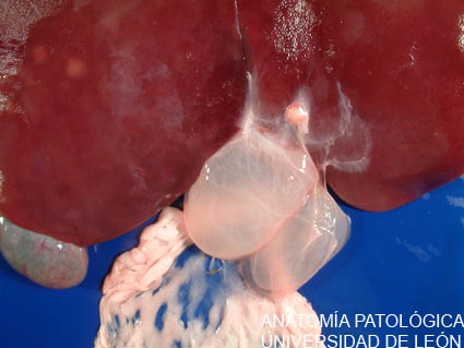 <p>Perihepatitis fibrosa focal. Vesículas viables de Cysticercus tenucollis.</p>