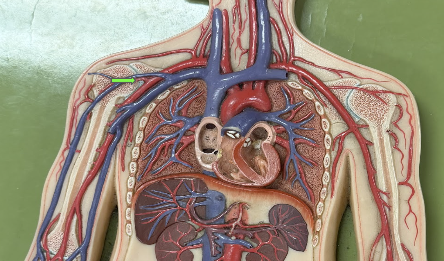 <p>What vein is this </p>