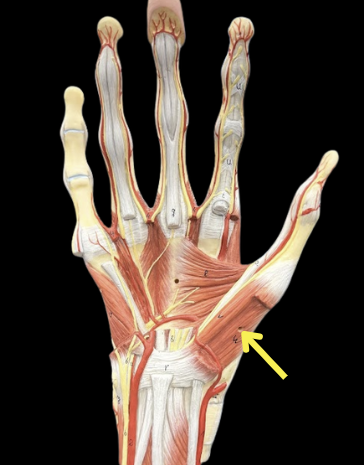 term image