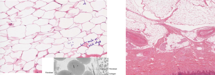 <p>What is adipose CT and how do you identify it?</p>