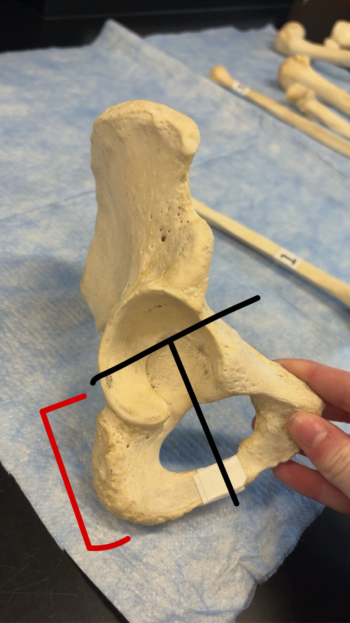 <p>Name this structure</p>
