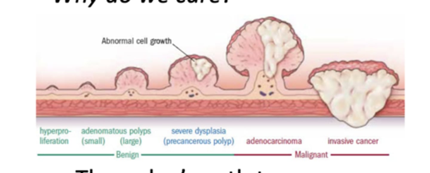 <p>get larger --&gt; severe dysplasia (precancerous polyp) --&gt; adenocarcinoma --&gt; invasive cancer</p>