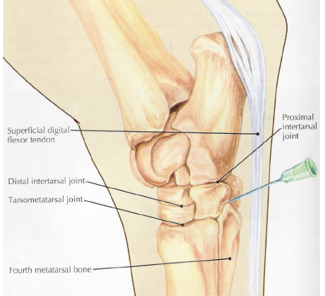 <p>what is desensitized in a tarsometatarsal joint block</p>