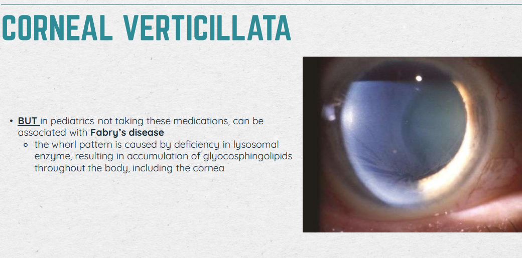 <ul><li><p>Associated with: Amiodarone, hydroxychloroquine, chloroquine, indomethacin, and phenothiazine</p></li><li><p>Doesn’t stain, stable with blink</p></li><li><p>BOARDS QUESTION: Side effects from taking these medications but children won’t be taking these medications » ddx goes to Fabry’s disease</p></li><li><p>Cannot process well so it accumulates in the body (ex. in the cornea)</p></li><li><p>Seen in 70% of Pts with Fabry’s (X-linked female carriers may only have corneal signs of Fabry’s)</p></li></ul><p></p>