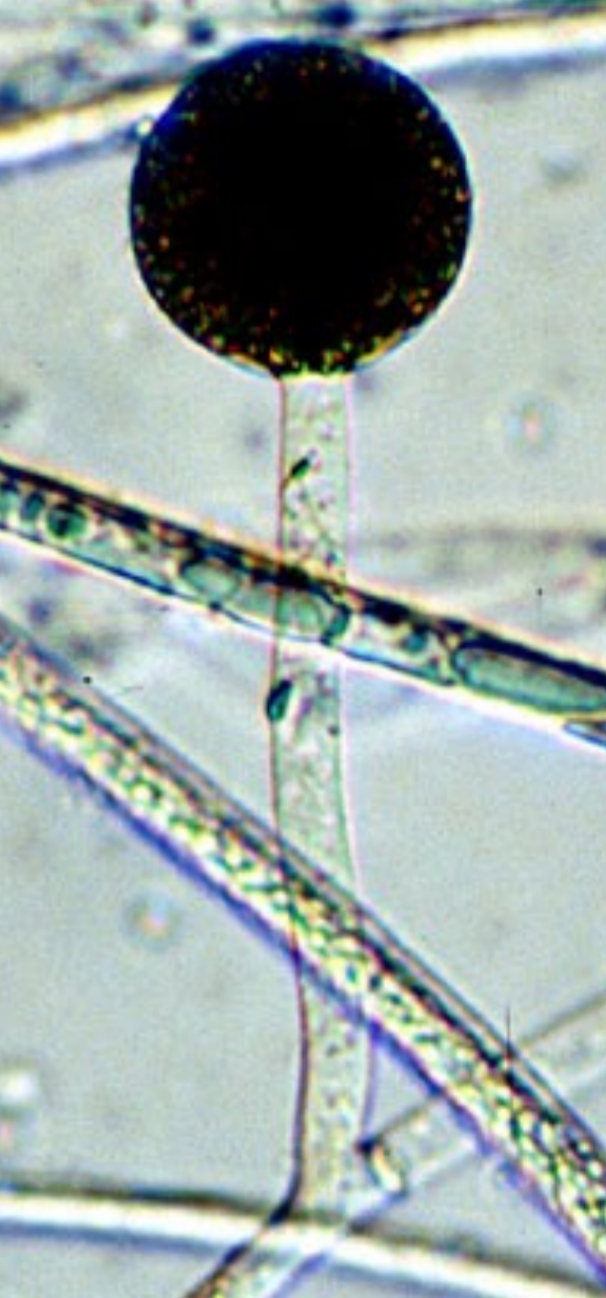 <p>globose with deliquescent wall with zygosporangia that have brown to black roughened wall</p>