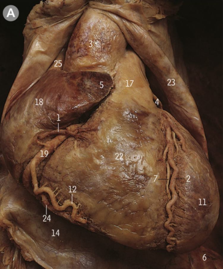 <p>What is 4?</p>