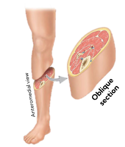 <p>Section is being cut at an angle</p><p>doesn’t follow standard anatomical planes</p><p>anteromedial view </p>