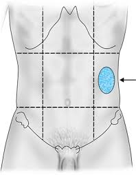 <p>Left side of the lumbar region, primarily containing parts of the large intestine and left kidney. </p>