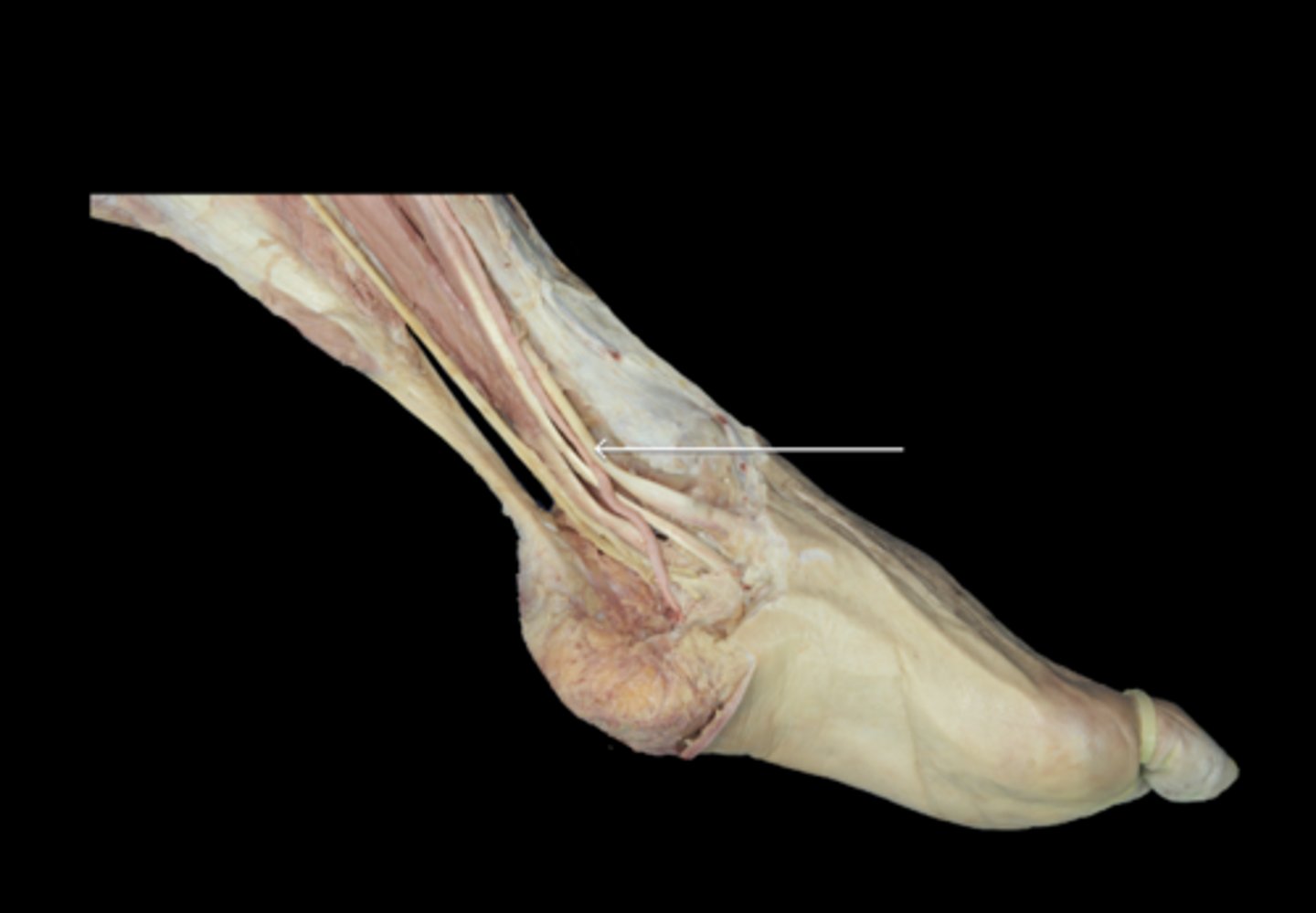 <p>Which tendon is the arrow indicating?</p>
