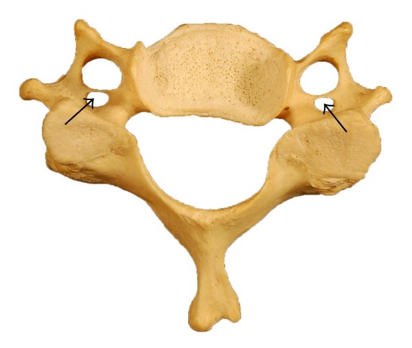 <p>(on cervical vertebrae only)</p>