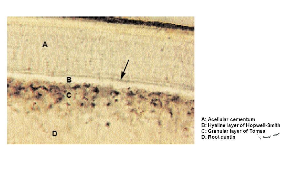 <ul><li><p>En del av rotspecifika-dentinet (tillsammans med hyalindentin)</p></li><li><p>ligger närmst circumpulpal dentin</p></li></ul><p></p>