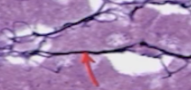 <p>Identify the pointed structure. Note how darkly-stained it is due to its attraction to Silver stain. </p>