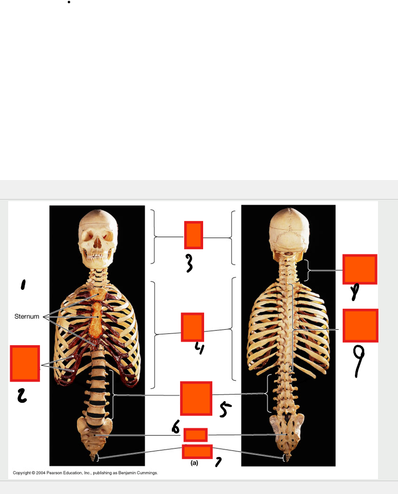 <p>Sternum</p>