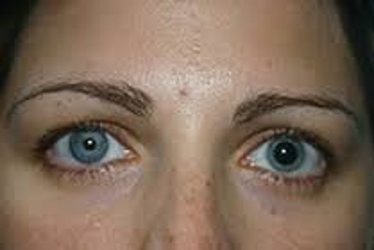 <p>a condition in which the pupils are unequal in size</p>