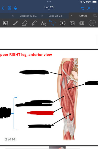 <p>What muscle is this?</p>