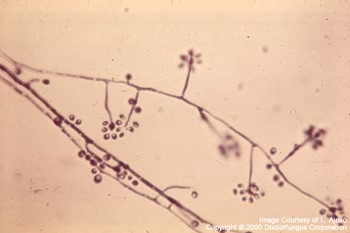 ==Rosettes== at the end of delicate denticles in mould form

  