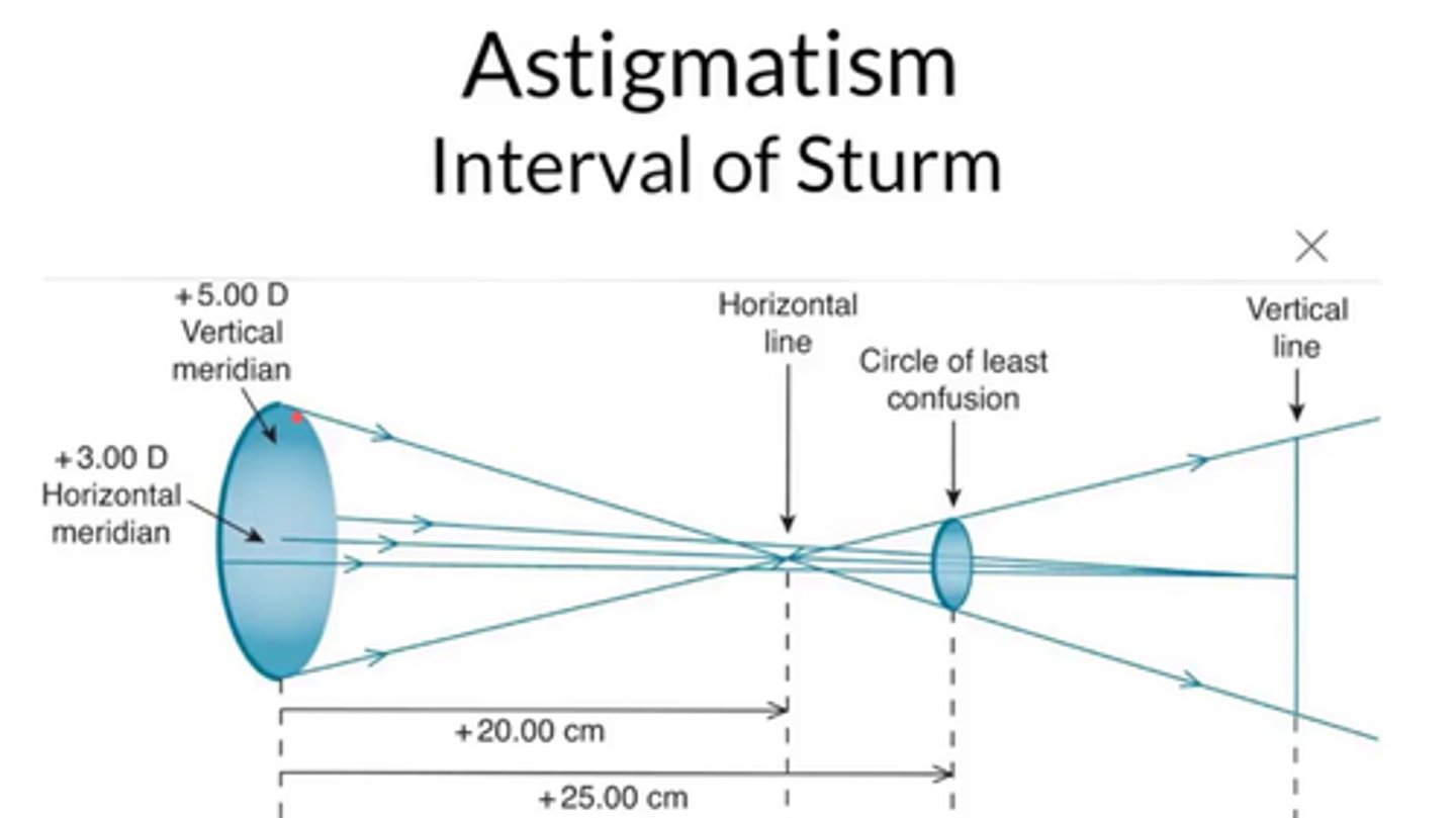<p>patients will accommodate to bring the circle of least confusion (COLC) near the retina</p><p>think of this as the average between the two meridians</p>