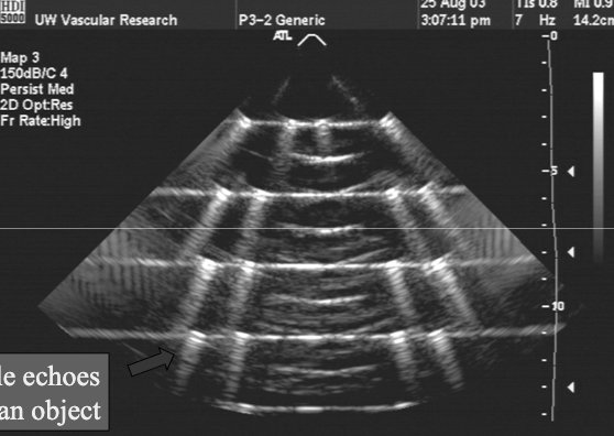 term image