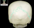 <p>between parietal bones and occipital bone</p>