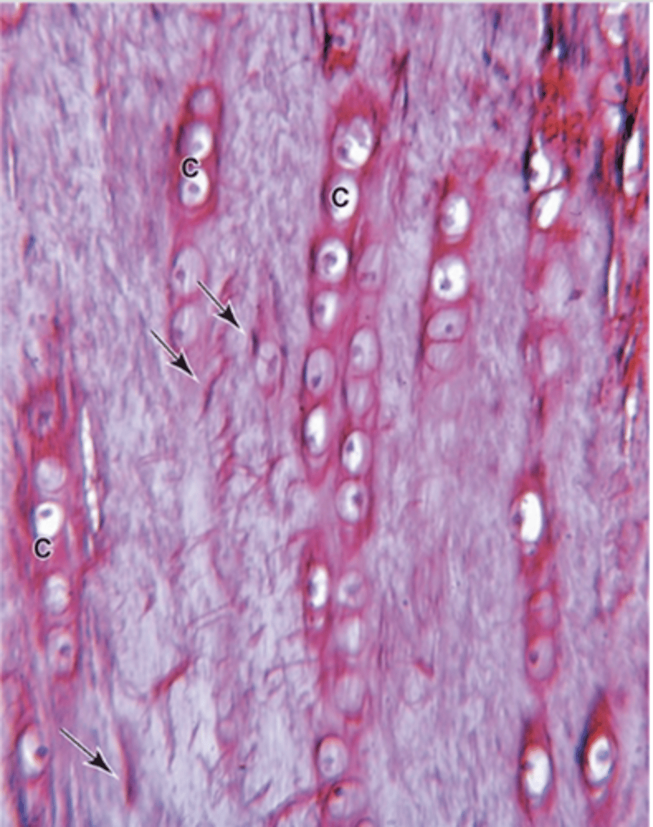 <p>What is the main function of fibrocartilage?</p>
