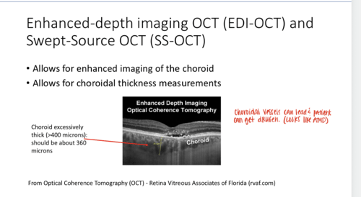 <p>What do Enhanced-depth imaging (EDI-OCT) &amp; Swept Source OCT (SS-OCT) allow for?</p>