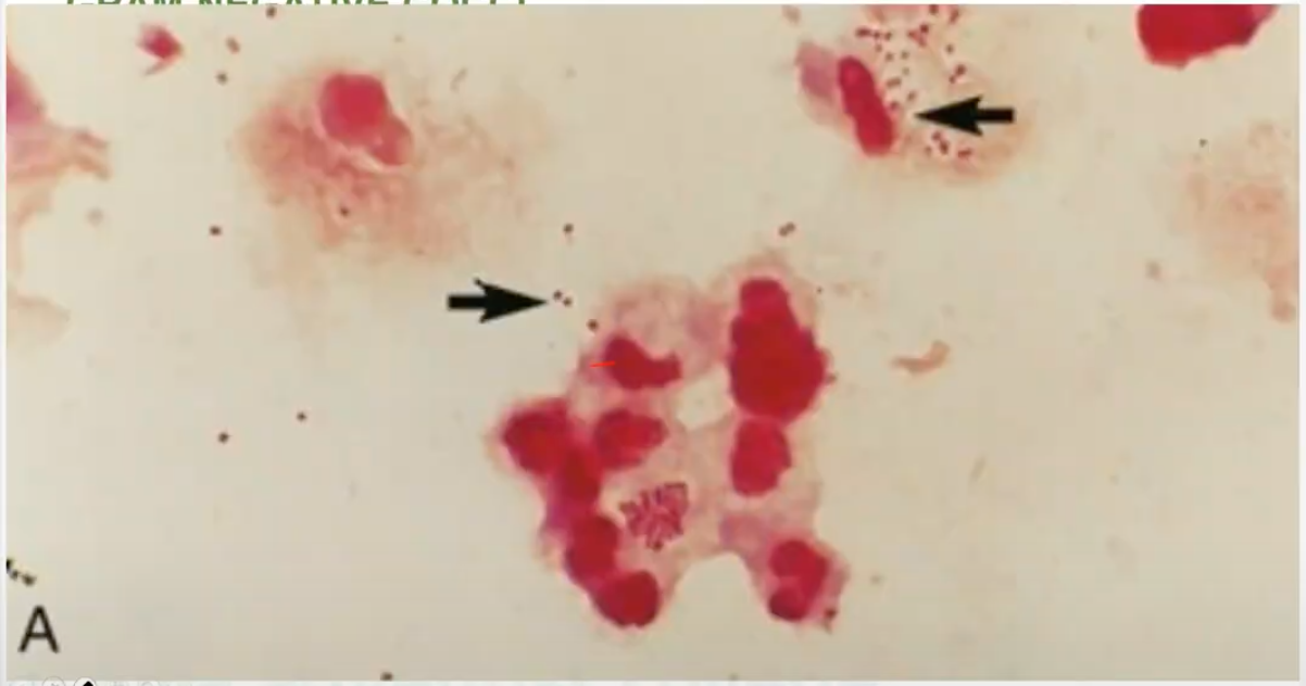 <p>kidney, coffee bean-shaped</p>