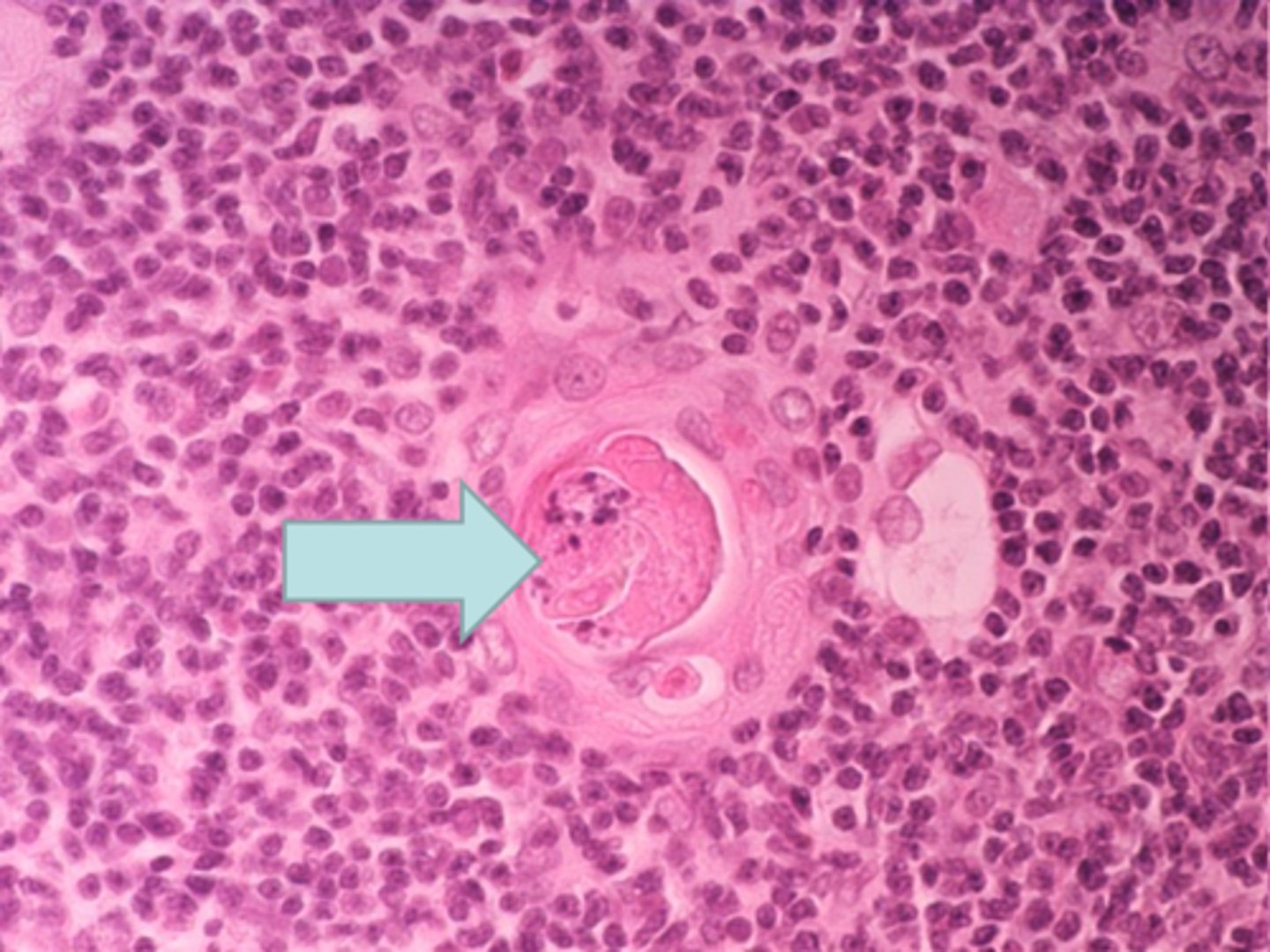 <p>blue arrow Thymus - Hassall´s corpuscle</p>