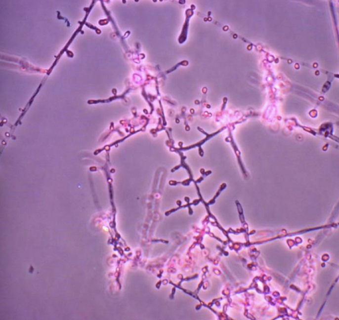 <p>Trichophyton tonsurans</p>