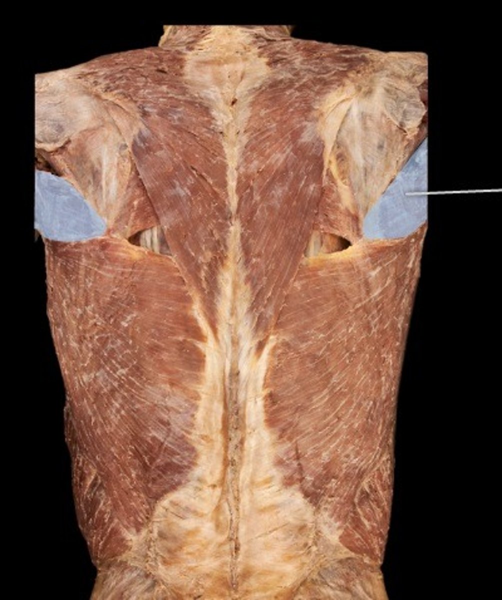 <p>What muscle is this?</p>