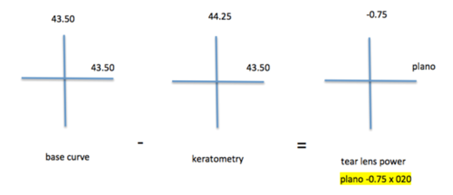 <p>plano -0.75 x 020</p><p>Tear lens (TL) = base curve (BC) - keratometry</p>