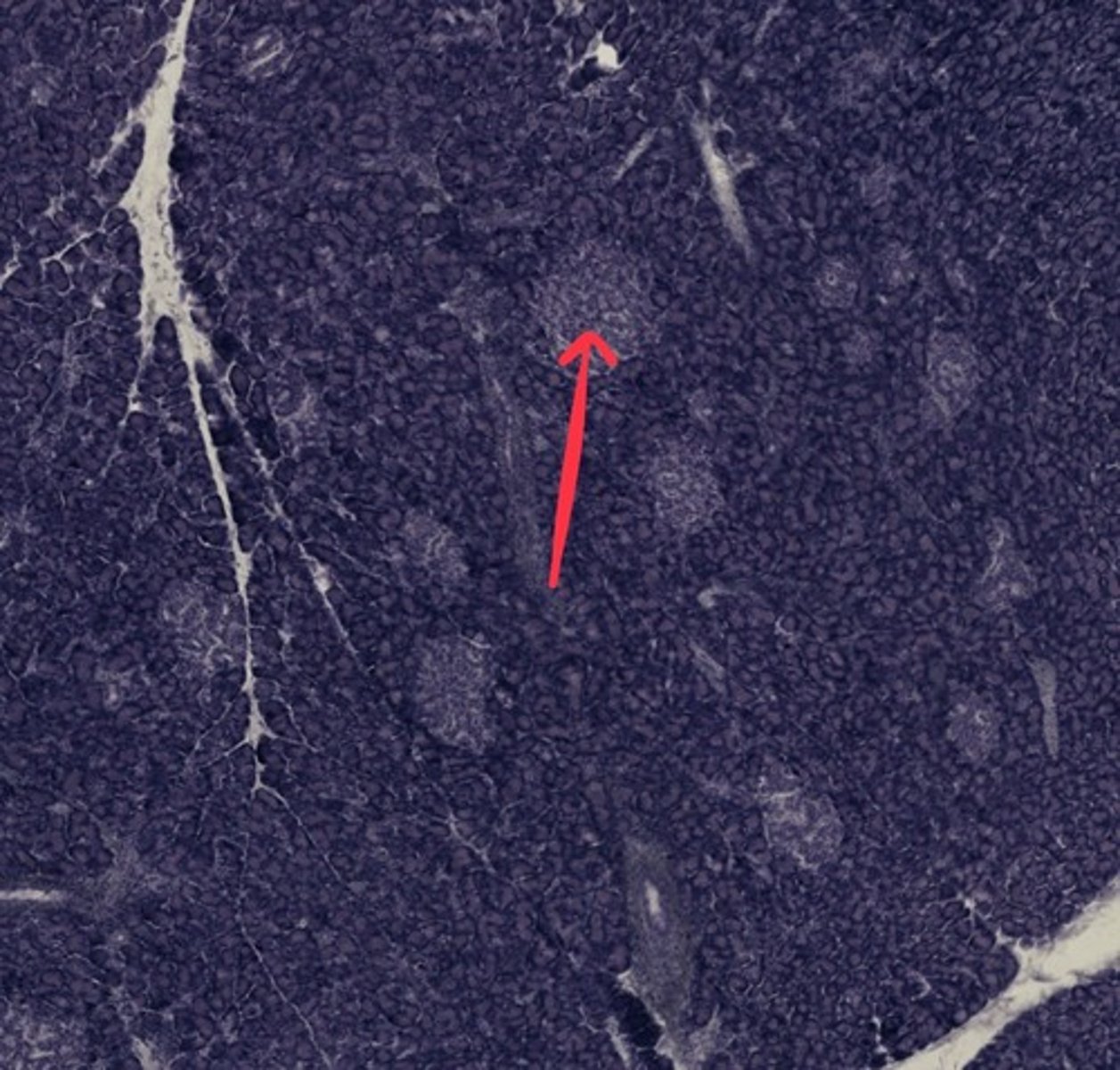 <p>Name the structure/tissue</p>