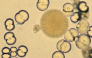 <ol start="71">
<li>What are Calcium Carbonates?</li>
</ol>
